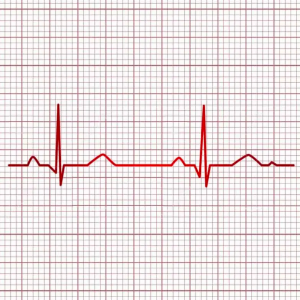 ELECTROCARDIOGRAMA